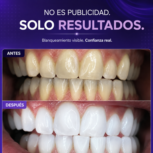 SMILEBRO Tiras Blanqueadoras V-34 con PAP+ — 14 Tratamientos