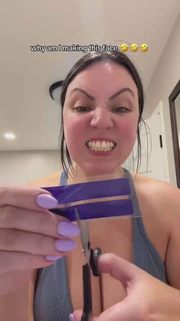 La gente no para de compartir su transformación de sonrisa